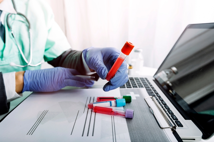 Foto principal de Aterosclerosis