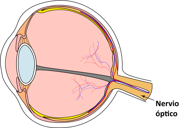 Neuritis óptica