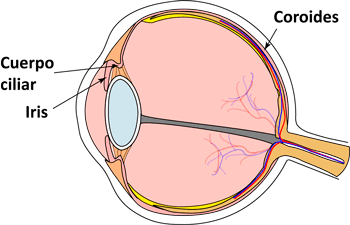 Uveitis