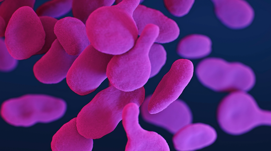 virus de Marburgo