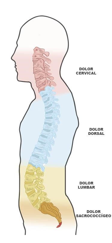 Dolor de espalda
