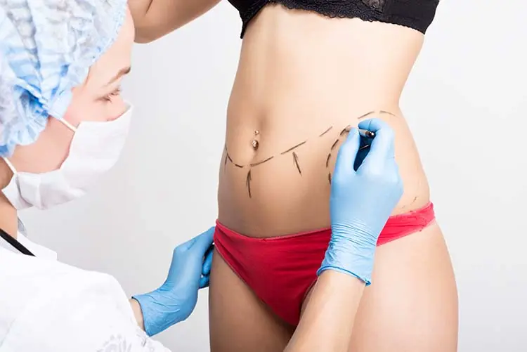 Foto principal de Abdominoplastia