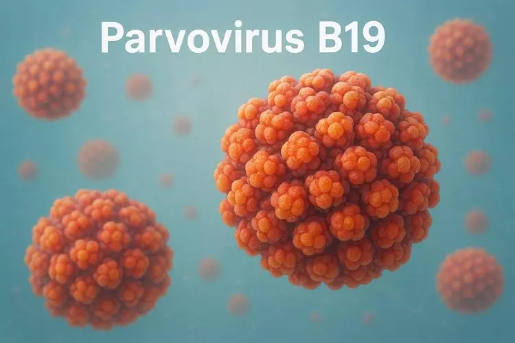 Foto principal de Infección por parvovirus