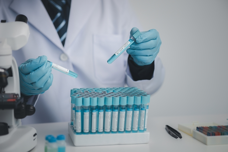 Foto principal de Síndrome de Goodpasture