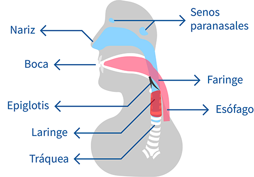 laringitis