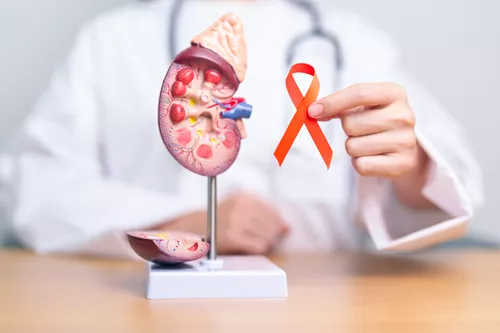 Cáncer de riñón
