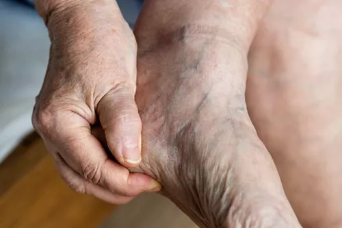Cuidados de los pies diabéticos