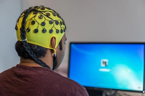 Diagnóstico de la epilepsia