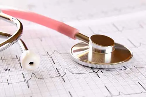 Enfermedad coronaria: Pruebas básicas de diagnóstico en cardiología