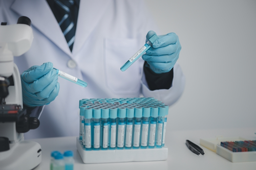 Síndrome de Goodpasture