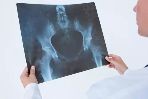 Urografía