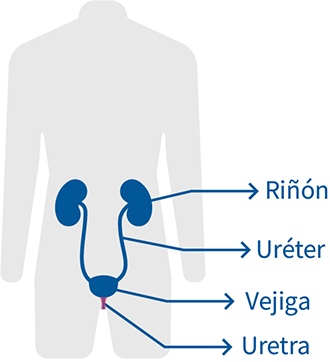 uretritis